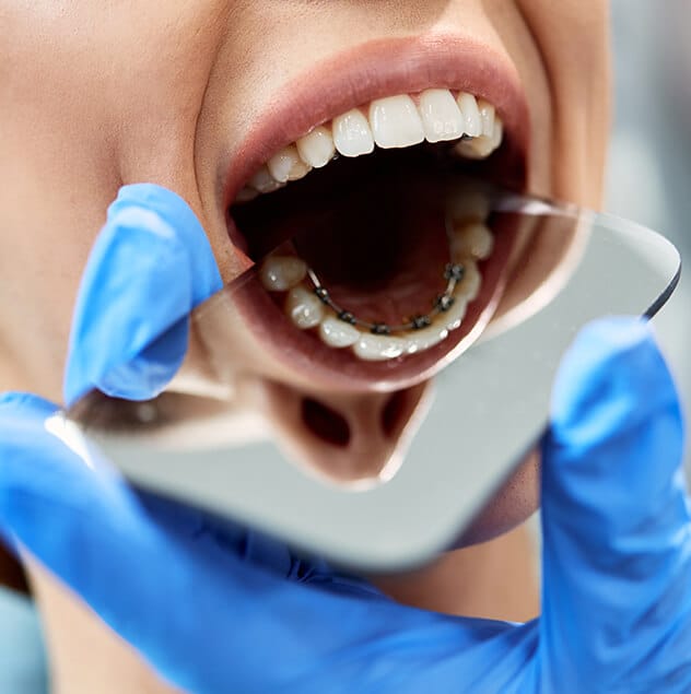 We offer a Lite version of Incognito braces