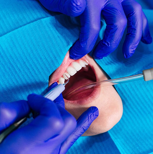 Treatment of gum disease