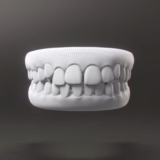 Dental Monitoring can fit your dream smile